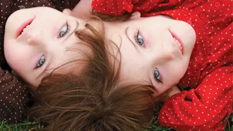 Strangest Birth Defects