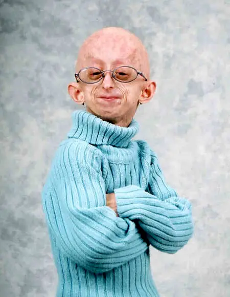 Strangest Birth Defects